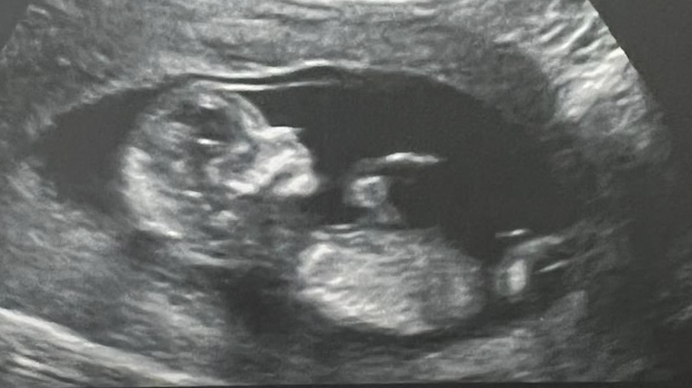 97150d81-a18f-4a7f-bf80-73b899621536